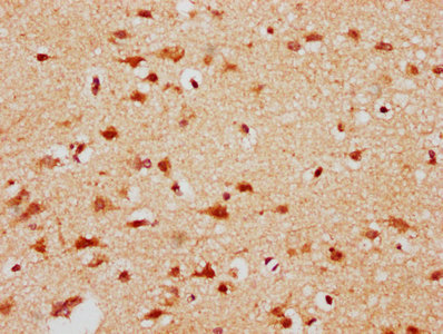 IHC image of CSB-PA004600EA01HU diluted at 1:300 and staining in paraffin-embedded human brain tissue performed on a Leica BondTM system. After dewaxing and hydration, antigen retrieval was mediated by high pressure in a citrate buffer (pH 6.0). Section was blocked with 10% normal goat serum 30min at RT. Then primary antibody (1% BSA) was incubated at 4°C overnight. The primary is detected by a biotinylated secondary antibody and visualized using an HRP conjugated SP system.