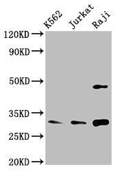 Western Blotting(WB) 2- CCND3 Antibody