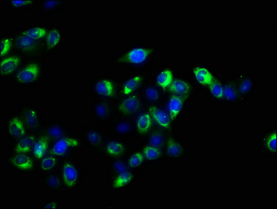 Immunofluorescence(IF) - CD47 Antibody