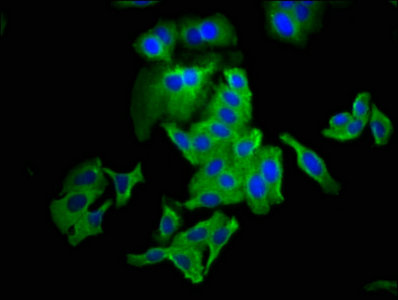 Immunofluorescence(IF) - CLDN6 Antibody