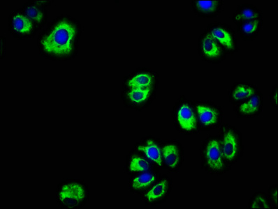 Immunofluorescence(IF) - EGFR Antibody