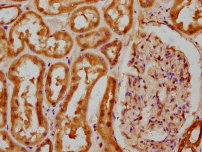 IHC image of CSB-PA005746LA01HU diluted at 1:100 and staining in paraffin-embedded human kidney tissue performed on a Leica BondTM system. After dewaxing and hydration, antigen retrieval was mediated by high pressure in a citrate buffer (pH 6.0). Section was blocked with 10% normal goat serum 30min at RT. Then primary antibody (1% BSA) was incubated at 4°C overnight. The primary is detected by a biotinylated secondary antibody and visualized using an HRP conjugated SP system.