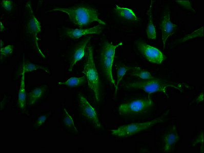 Immunofluorescence(IF) - CRYAB Antibody