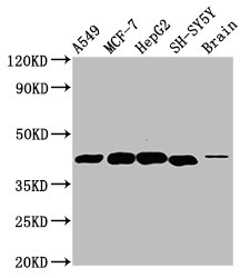 Western Blot Positive WB detected in: A549 whole cell lysate, MCF-7 whole cell lysate, HepG2 whole cell lysate, SH-SY5Y whole cell lysate, Rat brain tissue All lanes: DLK1 antibody at 4.6microg/ml Secondary Goat polyclonal to rabbit IgG at 1/50000 dilution Predicted band size: 42, 34 kDa Observed band size: 42 kDa