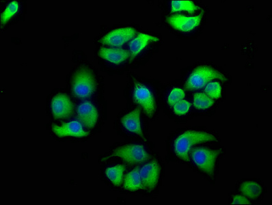 Immunofluorescence staining of Hela cells with CSB-PA007512LA01HU at 1:100, counter-stained with DAPI. The cells were fixed in 4% formaldehyde, permeabilized using 0.2% Triton X-100 and blocked in 10% normal Goat Serum. The cells were then incubated with the antibody overnight at 4°C. The secondary antibody was Alexa Fluor 488-congugated AffiniPure Goat Anti-Rabbit IgG(H+L).