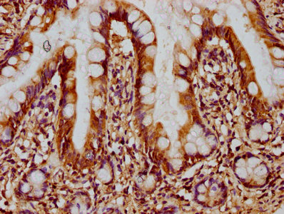 IHC image of CSB-PA007512LA01HU diluted at 1:300 and staining in paraffin-embedded human small intestine tissue performed on a Leica BondTM system. After dewaxing and hydration, antigen retrieval was mediated by high pressure in a citrate buffer (pH 6.0). Section was blocked with 10% normal goat serum 30min at RT. Then primary antibody (1% BSA) was incubated at 4°C overnight. The primary is detected by a biotinylated secondary antibody and visualized using an HRP conjugated SP system.