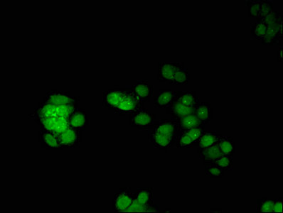 Immunofluorescent analysis of PC-3 cells using CSB-PA007781HA01HU at dilution of 1:100 and Alexa Fluor 488-congugated AffiniPure Goat Anti-Rabbit IgG(H+L)