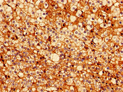 Immunohistochemistry of paraffin-embedded human adrenal gland tissue using CSB-PA007781HA01HU at dilution of 1:100