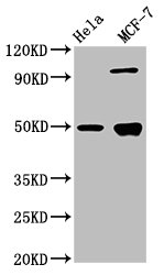 Western Blotting(WB) 3- GFAP Antibody