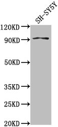 Western Blot Positive WB detected in: SH-SY5Y whole cell lysate All lanes: GPLD1 antibody at 1:2000 Secondary Goat polyclonal to rabbit IgG at 1/50000 dilution Predicted band size: 93, 20 kDa Observed band size: 93 kDa Western Blot Positive WB detected in: SH-SY5Y whole cell lysate All lanes: GPLD1 antibody at 1:2000 Secondary Goat polyclonal to rabbit IgG at 1/50000 dilution Predicted band size: 93, 20 kDa Observed band size: 93 kDa