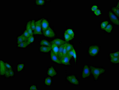 Immunofluorescence staining of HepG2 cells with CSB-PA009926LA01HU at 1:166, counter-stained with DAPI. The cells were fixed in 4% formaldehyde, permeabilized using 0.2% Triton X-100 and blocked in 10% normal Goat Serum. The cells were then incubated with the antibody overnight at 4°C. The secondary antibody was Alexa Fluor 488-congugated AffiniPure Goat Anti-Rabbit IgG(H+L).