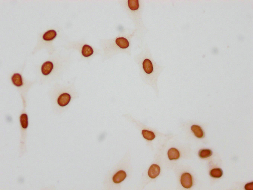 Immunocytochemistry analysis of CSB-PA010376OA21acHU diluted at 1:25 and staining in Hela cells(treated with 30mM sodium butyrate for 4h) performed on a Leica BondTM system. The cells were fixed in 4% formaldehyde, permeabilized using 0.2% Triton X-100 and blocked with 10% normal goat serum 30min at RT. Then primary antibody (1% BSA) was incubated at 4°C overnight. The primary is detected by a biotinylated secondary antibody and visualized using an HRP conjugated SP system. Immunocytochemistry analysis of CSB-PA010376OA21acHU diluted at 1:25 and staining in Hela cells(treated with 30mM sodium butyrate for 4h) performed on a Leica BondTM system. The cells were fixed in 4% formaldehyde, permeabilized using 0.2% Triton X-100 and blocked with 10% normal goat serum 30min at RT. Then primary antibody (1% BSA) was incubated at 4°C overnight. The primary is detected by a biotinylated secondary antibody and visualized using an HRP conjugated SP system.