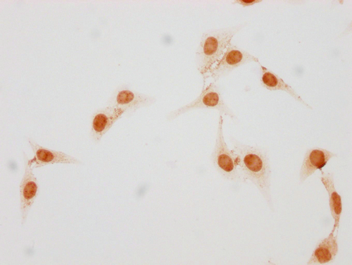 Immunocytochemistry analysis of CSB-PA010377OA17phHU diluted at 1:25 and staining in Hela cells(treated with 50nM Calyculin A for 30min) performed on a Leica BondTM system. The cells were fixed in 4% formaldehyde, permeabilized using 0.2% Triton X-100 and blocked with 10% normal goat serum 30min at RT. Then primary antibody (1% BSA) was incubated at 4°C overnight. The primary is detected by a biotinylated secondary antibody and visualized using an HRP conjugated SP system.