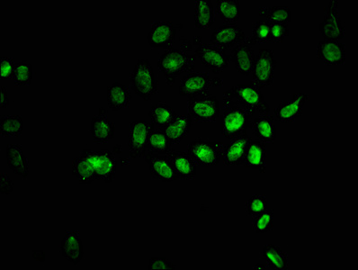 Immunofluorescence(IF) - 2-hydroxyisobutyryl-HIST1H1C (K135) Antibody