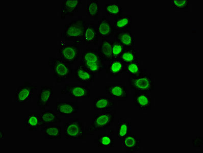 Immunofluorescence(IF) - HIST1H1C (Ab-25) Antibody