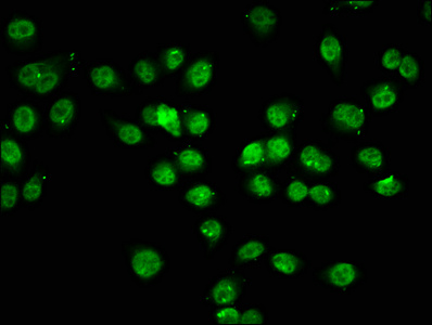 Immunofluorescence(IF) - Acetyl-HIST1H1C (K74) Antibody