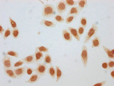 Immunocytochemistry analysis of CSB-PA010379OA75bhbHU diluted at 1:10 and staining in Hela cells (treated with 50mM sodium 3-hydroxybutyrate for 4h) performed on a Leica BondTM system. The cells were fixed in 4% formaldehyde, permeabilized using 0.2% Triton X-100 and blocked with 10% normal goat serum 30min at RT. Then primary antibody (1% BSA) was incubated at 4°C overnight. The primary is detected by a biotinylated secondary antibody and visualized using an HRP conjugated SP system.