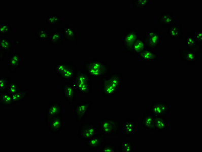Immunofluorescence staining of Hela cells with CSB-PA010380OA45nacHU at 1:2.5, counter-stained with DAPI. The cells were fixed in 4% formaldehyde, permeabilized using 0.2% Triton X-100 and blocked in 10% normal Goat Serum. The cells were then incubated with the antibody overnight at 4°C. The secondary antibody was Alexa Fluor 488-congugated AffiniPure Goat Anti-Rabbit IgG(H+L).