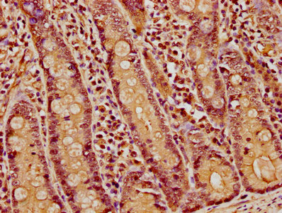 IHC image of CSB-PA010380OA45nacHU diluted at 1:5 and staining in paraffin-embedded human small intestine tissue performed on a Leica BondTM system. After dewaxing and hydration, antigen retrieval was mediated by high pressure in a citrate buffer (pH 6.0). Section was blocked with 10% normal goat serum 30min at RT. Then primary antibody (1% BSA) was incubated at 4°C overnight. The primary is detected by a biotinylated secondary antibody and visualized using an HRP conjugated SP system.