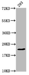 Western Blot Positive WB detected in: 293 whole cell lysate All lanes: HIST1H1E antibody at 0.94microg/ml Secondary Goat polyclonal to rabbit IgG at 1/50000 dilution Predicted band size: 22 kDa Observed band size: 22 kDa Western Blot Positive WB detected in: 293 whole cell lysate All lanes: HIST1H1E antibody at 0.94microg/ml Secondary Goat polyclonal to rabbit IgG at 1/50000 dilution Predicted band size: 22 kDa Observed band size: 22 kDa