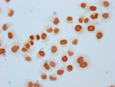 Immunocytochemistry analysis of CSB-PA010380PA25me1HU diluted at 1:5 and staining in Hela cells performed on a Leica BondTM system. The cells were fixed in 4% formaldehyde, permeabilized using 0.2% Triton X-100 and blocked with 10% normal goat serum 30min at RT. Then primary antibody (1% BSA) was incubated at 4°C overnight. The primary is detected by a biotinylated secondary antibody and visualized using an HRP conjugated SP system.