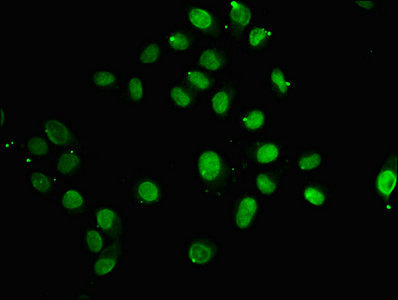 Immunofluorescence staining of Hela cells with CSB-PA010389OA118nforHU at 1:5, counter-stained with DAPI. The cells were fixed in 4% formaldehyde, permeabilized using 0.2% Triton X-100 and blocked in 10% normal Goat Serum. The cells were then incubated with the antibody overnight at 4°C. The secondary antibody was Alexa Fluor 488-congugated AffiniPure Goat Anti-Rabbit IgG(H+L).