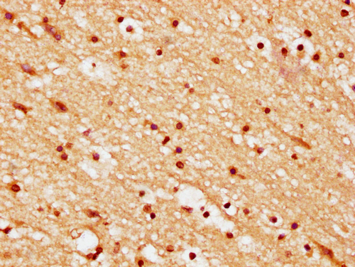 IHC image of CSB-PA010389PA36nsucHU diluted at 1:10 and staining in paraffin-embedded human brain tissue performed on a Leica BondTM system. After dewaxing and hydration, antigen retrieval was mediated by high pressure in a citrate buffer (pH 6.0). Section was blocked with 10% normal goat serum 30min at RT. Then primary antibody (1% BSA) was incubated at 4°C overnight. The primary is detected by a biotinylated secondary antibody and visualized using an HRP conjugated SP system.