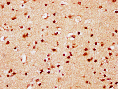 IHC image of CSB-PA010389PA95nsucHU diluted at 1:10 and staining in paraffin-embedded human brain tissue performed on a Leica BondTM system. After dewaxing and hydration, antigen retrieval was mediated by high pressure in a citrate buffer (pH 6.0). Section was blocked with 10% normal goat serum 30min at RT. Then primary antibody (1% BSA) was incubated at 4°C overnight. The primary is detected by a biotinylated secondary antibody and visualized using an HRP conjugated SP system.