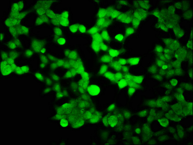 Immunofluorescence staining of 293 cells with CSB-PA010411LA01HU at 1:100, counter-stained with DAPI. The cells were fixed in 4% formaldehyde, permeabilized using 0.2% Triton X-100 and blocked in 10% normal Goat Serum. The cells were then incubated with the antibody overnight at 4°C. The secondary antibody was Alexa Fluor 488-congugated AffiniPure Goat Anti-Rabbit IgG(H+L).