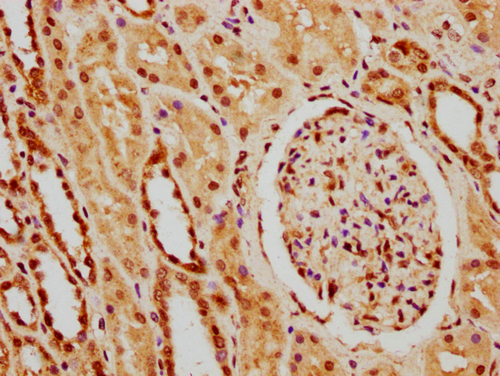 IHC image of CSB-PA010418PA41nphHU diluted at 1:20 and staining in paraffin-embedded human kidney tissue performed on a Leica BondTM system. After dewaxing and hydration, antigen retrieval was mediated by high pressure in a citrate buffer (pH 6.0). Section was blocked with 10% normal goat serum 30min at RT. Then primary antibody (1% BSA) was incubated at 4°C overnight. The primary is detected by a biotinylated secondary antibody and visualized using an HRP conjugated SP system.