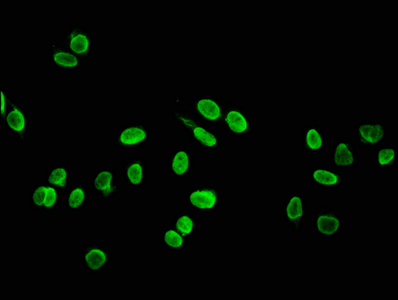 Immunofluorescence staining of Hela cells (treated with 30mM sodium butyrate for 4h) with CSB-PA010429OA88ohHU at 1:5, counter-stained with DAPI. The cells were fixed in 4% formaldehyde, permeabilized using 0.2% Triton X-100 and blocked in 10% normal Goat Serum. The cells were then incubated with the antibody overnight at 4°C. The secondary antibody was Alexa Fluor 488-congugated AffiniPure Goat Anti-Rabbit IgG(H+L).