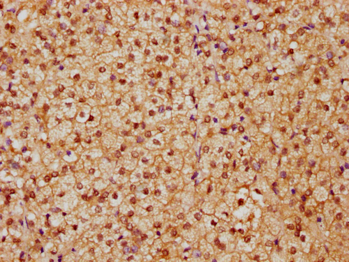 IHC image of CSB-PA010429PA91nhibHU diluted at 1:20 and staining in paraffin-embedded human adrenal gland tissue performed on a Leica BondTM system. After dewaxing and hydration, antigen retrieval was mediated by high pressure in a citrate buffer (pH 6.0). Section was blocked with 10% normal goat serum 30min at RT. Then primary antibody (1% BSA) was incubated at 4°C overnight. The primary is detected by a biotinylated secondary antibody and visualized using an HRP conjugated SP system. IHC image of CSB-PA010429PA91nhibHU diluted at 1:20 and staining in paraffin-embedded human adrenal gland tissue performed on a Leica BondTM system. After dewaxing and hydration, antigen retrieval was mediated by high pressure in a citrate buffer (pH 6.0). Section was blocked with 10% normal goat serum 30min at RT. Then primary antibody (1% BSA) was incubated at 4°C overnight. The primary is detected by a biotinylated secondary antibody and visualized using an HRP conjugated SP system.