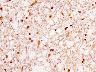 IHC image of CSB-PA010600HA01HU diluted at 1:300 and staining in paraffin-embedded human brain tissue performed on a Leica BondTM system. After dewaxing and hydration, antigen retrieval was mediated by high pressure in a citrate buffer (pH 6.0). Section was blocked with 10% normal goat serum 30min at RT. Then primary antibody (1% BSA) was incubated at 4°C overnight. The primary is detected by a biotinylated secondary antibody and visualized using an HRP conjugated SP system.