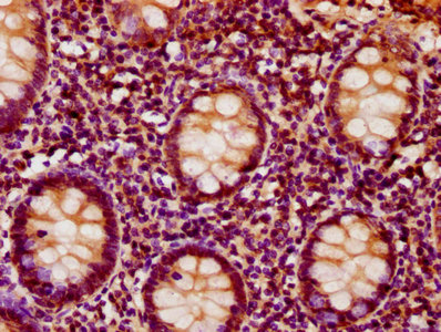IHC image of CSB-PA011921LA01HU diluted at 1:500 and staining in paraffin-embedded human appendix tissue performed on a Leica BondTM system. After dewaxing and hydration, antigen retrieval was mediated by high pressure in a citrate buffer (pH 6.0). Section was blocked with 10% normal goat serum 30min at RT. Then primary antibody (1% BSA) was incubated at 4°C overnight. The primary is detected by a biotinylated secondary antibody and visualized using an HRP conjugated SP system. IHC image of CSB-PA011921LA01HU diluted at 1:500 and staining in paraffin-embedded human appendix tissue performed on a Leica BondTM system. After dewaxing and hydration, antigen retrieval was mediated by high pressure in a citrate buffer (pH 6.0). Section was blocked with 10% normal goat serum 30min at RT. Then primary antibody (1% BSA) was incubated at 4°C overnight. The primary is detected by a biotinylated secondary antibody and visualized using an HRP conjugated SP system.