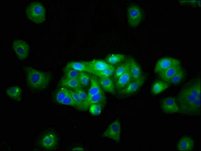 Immunofluorescence staining of HepG2 cells with CSB-PA012048LA01HU at 1:133, counter-stained with DAPI. The cells were fixed in 4% formaldehyde, permeabilized using 0.2% Triton X-100 and blocked in 10% normal Goat Serum. The cells were then incubated with the antibody overnight at 4°C. The secondary antibody was Alexa Fluor 488-congugated AffiniPure Goat Anti-Rabbit IgG(H+L).