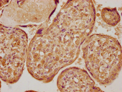 IHC image of CSB-PA013038LA01HU diluted at 1:400 and staining in paraffin-embedded human placenta tissue performed on a Leica BondTM system. After dewaxing and hydration, antigen retrieval was mediated by high pressure in a citrate buffer (pH 6.0). Section was blocked with 10% normal goat serum 30min at RT. Then primary antibody (1% BSA) was incubated at 4°C overnight. The primary is detected by a biotinylated secondary antibody and visualized using an HRP conjugated SP system.