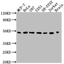 Western Blot Positive WB detected in: MCF-7 whole cell lysate, HeLa whole cell lysate, U87 whole cell lysate, U251 whole cell lysate, SH-SY5Y whole cell lysate, Jurkat whole cell lysate, Rat brain tissue All lanes: LOX antibody at 1:2000 Secondary Goat polyclonal to rabbit IgG at 1/50000 dilution Predicted band size: 47 kDa Observed band size: 47 kDa