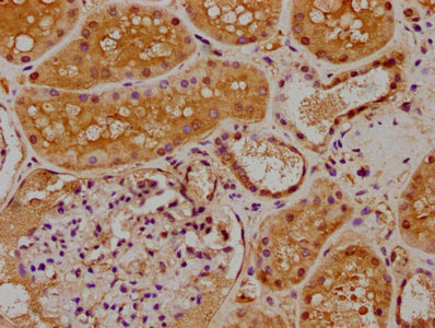 IHC image of CSB-PA013424LA01HU diluted at 1:400 and staining in paraffin-embedded human kidney tissue performed on a Leica BondTM system. After dewaxing and hydration, antigen retrieval was mediated by high pressure in a citrate buffer (pH 6.0). Section was blocked with 10% normal goat serum 30min at RT. Then primary antibody (1% BSA) was incubated at 4°C overnight. The primary is detected by a biotinylated secondary antibody and visualized using an HRP conjugated SP system.