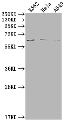 Western Blot Positive WB detected in: K562 whole cell lysate, Hela whole cell lysate, A549 whole cell lysate All lanes: MAP3K7 antibody at 1:500 Secondary Goat polyclonal to rabbit IgG at 1/50000 dilution Predicted band size: 68, 65, 57, 54 kDa Observed band size: 68 kDa