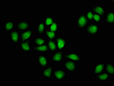 Immunofluorescence staining of Hela cells with CSB-PA013592LA01HU at 1:133, counter-stained with DAPI. The cells were fixed in 4% formaldehyde, permeabilized using 0.2% Triton X-100 and blocked in 10% normal Goat Serum. The cells were then incubated with the antibody overnight at 4°C. The secondary antibody was Alexa Fluor 488-congugated AffiniPure Goat Anti-Rabbit IgG(H+L).