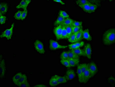 Immunofluorescence staining of HepG2 cells with CSB-PA015512LA01HU at 1:266, counter-stained with DAPI. The cells were fixed in 4% formaldehyde, permeabilized using 0.2% Triton X-100 and blocked in 10% normal Goat Serum. The cells were then incubated with the antibody overnight at 4°C. The secondary antibody was Alexa Fluor 488-congugated AffiniPure Goat Anti-Rabbit IgG(H+L).