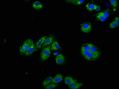 Immunofluorescence staining of HepG2 cells with CSB-PA015988LA01HU at 1:125, counter-stained with DAPI. The cells were fixed in 4% formaldehyde, permeabilized using 0.2% Triton X-100 and blocked in 10% normal Goat Serum. The cells were then incubated with the antibody overnight at 4°C. The secondary antibody was Alexa Fluor 488-congugated AffiniPure Goat Anti-Rabbit IgG(H+L).
