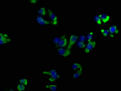 Immunofluorescence staining of HepG2 cells with CSB-PA016359OA01HU at 1:50, counter-stained with DAPI. The cells were fixed in 4% formaldehyde, permeabilized using 0.2% Triton X-100 and blocked in 10% normal Goat Serum. The cells were then incubated with the antibody overnight at 4°C. The secondary antibody was Alexa Fluor 488-congugated AffiniPure Goat Anti-Rabbit IgG(H+L).