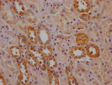 IHC image of CSB-PA017627LA01HU diluted at 1:200 and staining in paraffin-embedded human kidney tissue performed on a Leica BondTM system. After dewaxing and hydration, antigen retrieval was mediated by high pressure in a citrate buffer (pH 6.0). Section was blocked with 10% normal goat serum 30min at RT. Then primary antibody (1% BSA) was incubated at 4°C overnight. The primary is detected by a Goat anti-rabbit polymer IgG labeled by HRP and visualized using 0.05% DAB.