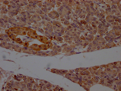 IHC image of CSB-PA017627LA11HU diluted at 1:200 and staining in paraffin-embedded human pancreatic tissue performed on a Leica BondTM system. After dewaxing and hydration, antigen retrieval was mediated by high pressure in a citrate buffer (pH 6.0). Section was blocked with 10% normal goat serum 30min at RT. Then primary antibody (1% BSA) was incubated at 4°C overnight. The primary is detected by a Goat anti-rabbit polymer IgG labeled by HRP and visualized using 0.05% DAB.
