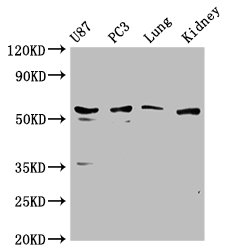 Western Blot Positive WB detected in: U87 whole cell lysate, PC3 whole cell lysate, Mouse lung tissue, Mouse kidney tissue All lanes: PPP5C antibody at 1:1000 Secondary Goat polyclonal to rabbit IgG at 1/50000 dilution Predicted band size: 57 kDa Observed band size: 57 kDa