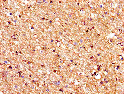 IHC image of CSB-PA018754LA01HU diluted at 1:200 and staining in paraffin-embedded human brain tissue performed on a Leica BondTM system. After dewaxing and hydration, antigen retrieval was mediated by high pressure in a citrate buffer (pH 6.0). Section was blocked with 10% normal goat serum 30min at RT. Then primary antibody (1% BSA) was incubated at 4°C overnight. The primary is detected by a biotinylated secondary antibody and visualized using an HRP conjugated SP system.