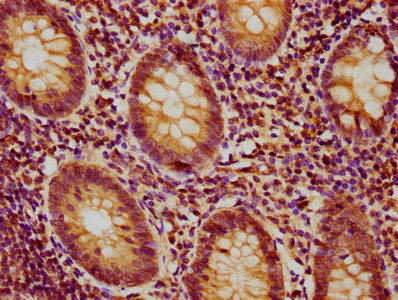 IHC image of CSB-PA018887LA01HU diluted at 1:400 and staining in paraffin-embedded human appendix tissue performed on a Leica BondTM system. After dewaxing and hydration, antigen retrieval was mediated by high pressure in a citrate buffer (pH 6.0). Section was blocked with 10% normal goat serum 30min at RT. Then primary antibody (1% BSA) was incubated at 4°C overnight. The primary is detected by a biotinylated secondary antibody and visualized using an HRP conjugated SP system.