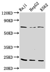 Western Blot Positive WB detected in: Raji whole cell lysate, HepG2 whole cell lysate, K562 whole cell lysate All lanes: PSMB9 antibody at 10microg/ml Secondary Goat polyclonal to rabbit IgG at 1/50000 dilution Predicted band size: 24, 23 kDa Observed band size: 24 kDa Western Blot Positive WB detected in: Raji whole cell lysate, HepG2 whole cell lysate, K562 whole cell lysate All lanes: PSMB9 antibody at 10microg/ml Secondary Goat polyclonal to rabbit IgG at 1/50000 dilution Predicted band size: 24, 23 kDa Observed band size: 24 kDa