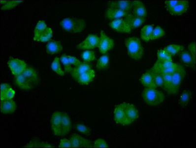 Immunofluorescence staining of HepG2 cells with CSB-PA019036LA01HU at 1:266, counter-stained with DAPI. The cells were fixed in 4% formaldehyde, permeabilized using 0.2% Triton X-100 and blocked in 10% normal Goat Serum. The cells were then incubated with the antibody overnight at 4°C. The secondary antibody was Alexa Fluor 488-congugated AffiniPure Goat Anti-Rabbit IgG(H+L). Immunofluorescence staining of HepG2 cells with CSB-PA019036LA01HU at 1:266, counter-stained with DAPI. The cells were fixed in 4% formaldehyde, permeabilized using 0.2% Triton X-100 and blocked in 10% normal Goat Serum. The cells were then incubated with the antibody overnight at 4°C. The secondary antibody was Alexa Fluor 488-congugated AffiniPure Goat Anti-Rabbit IgG(H+L).